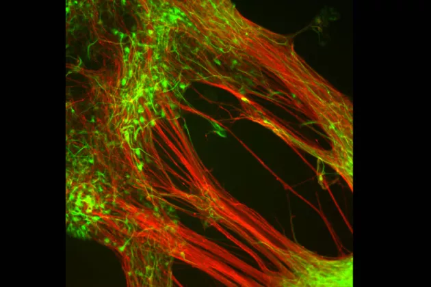 Dopamine-producing neurons that researchers from Lund University have grown in the laboratory from human embryonic stem cells (Photo: Agneta Kirby)